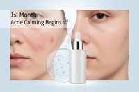 1st Month — Acne Calming Begins