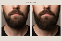 3–4 Weeks-Stronger & Healthier Beard