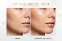 3–4 Weeks-Visible Brightening & Even Tone