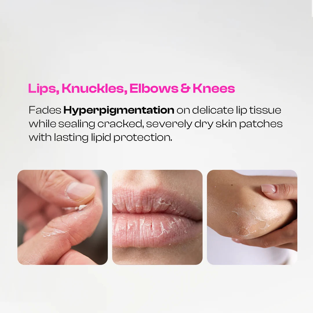 Multi-Use Balm for Dark Lips & Dry Skin | Kojic Acid Balm