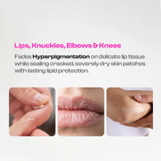 Multi-Use Balm for Dark Lips & Dry Skin | Kojic Acid Balm