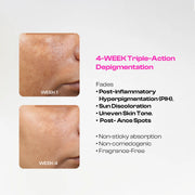 Depigmentation & Spot Correcting Serum |  Viniferine & Tranexamic Acid