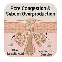 Clogged Pores & Impurities