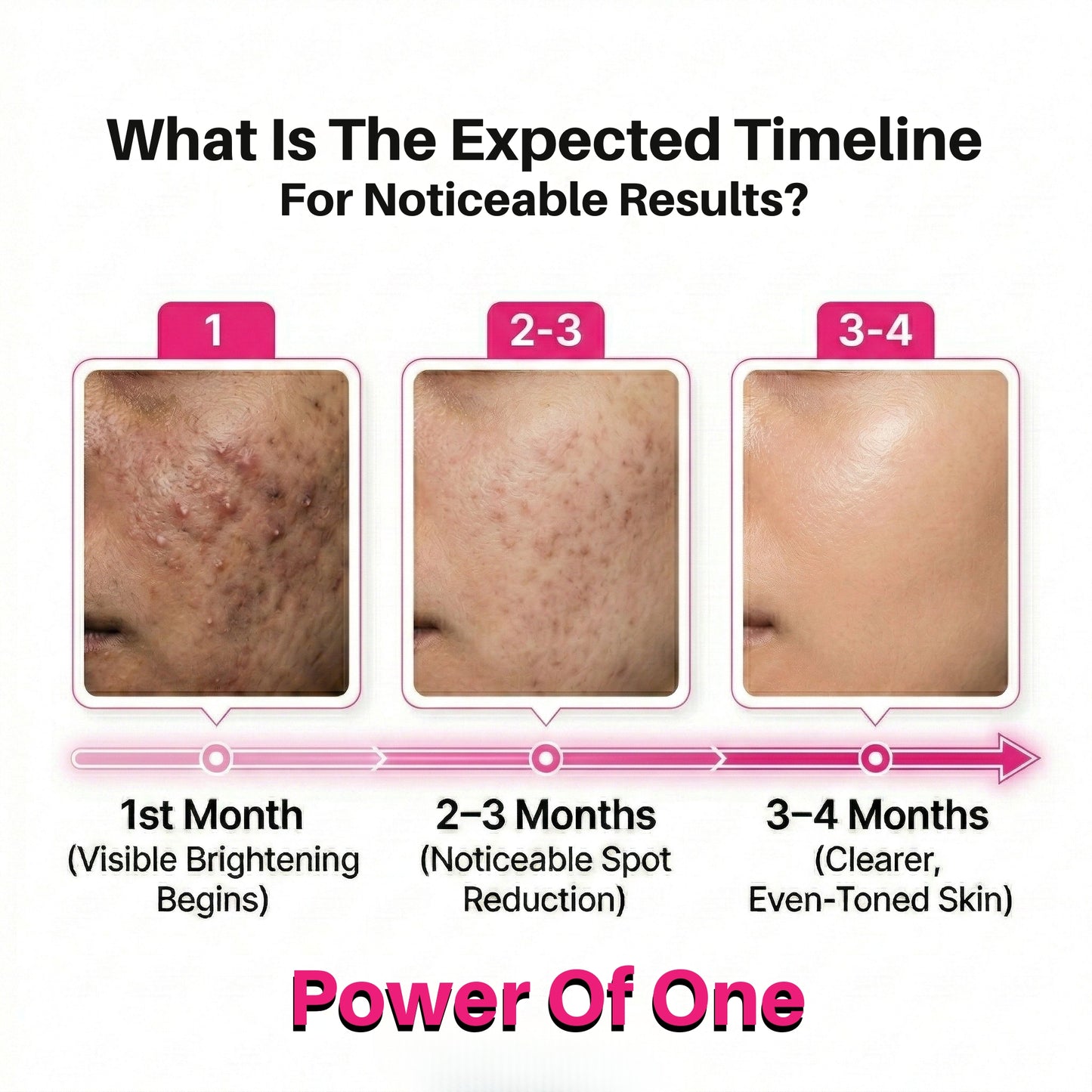 Dark Spot & Pigmentation Serum (30 ml) | Viniferine, Mandelic acid & Tranexamic Acid