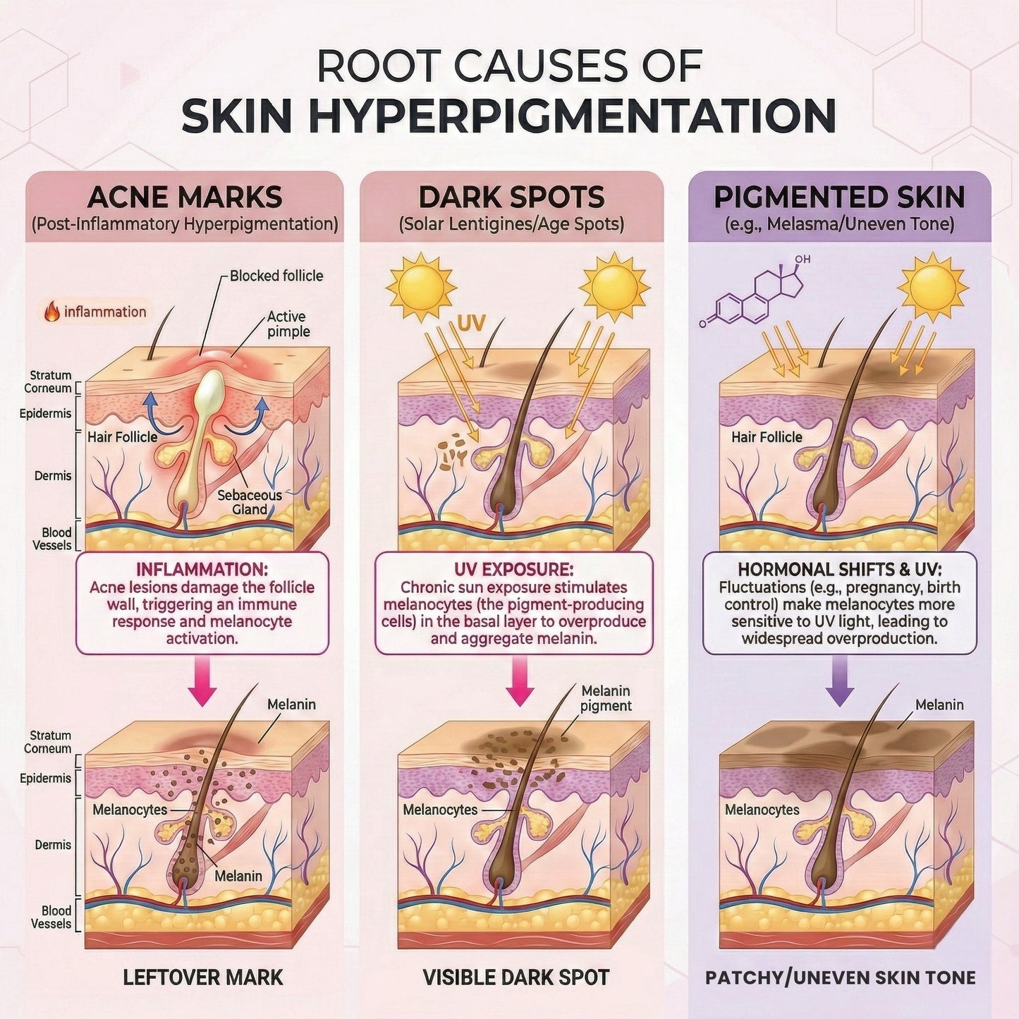 Dark Spot & Pigmentation Serum (30 ml) | Viniferine, Mandelic acid & Tranexamic Acid