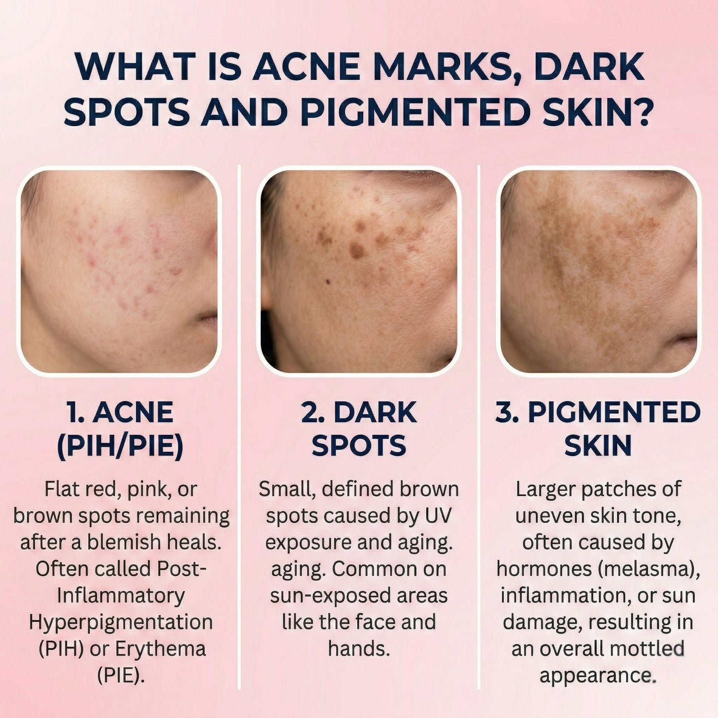 Dark Spot & Pigmentation Serum (30 ml) | Viniferine, Mandelic acid & Tranexamic Acid