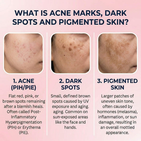 Dark Spot Reduction Serum for Pigmentation | Brightening Formula