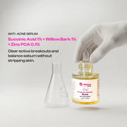 Anti Acne  Serum | Succinic Acid Acne Clarifying Serum