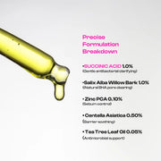 Anti Acne  Serum | Succinic Acid Acne Clarifying Serum