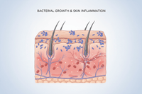 Bacterial Growth & Skin Inflammation