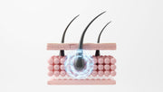 Root Strengthening Support