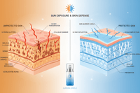 UV Exposure & Sun Damage