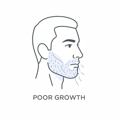 Weak Beard & Poor Growth
